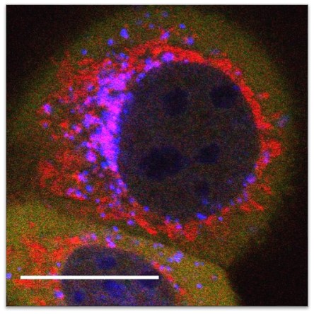 Autophagy regulates tumor cell response to chemotherapy by degrading the transcription factor FOXO3a to control apoptosis throug